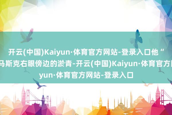 开云(中国)Kaiyun·体育官方网站-登录入口他“莫得注重到”马斯克右眼傍边的淤青-开云(中国)Kaiyun·体育官方网站-登录入口